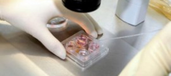 ЭКО в естественном цикле